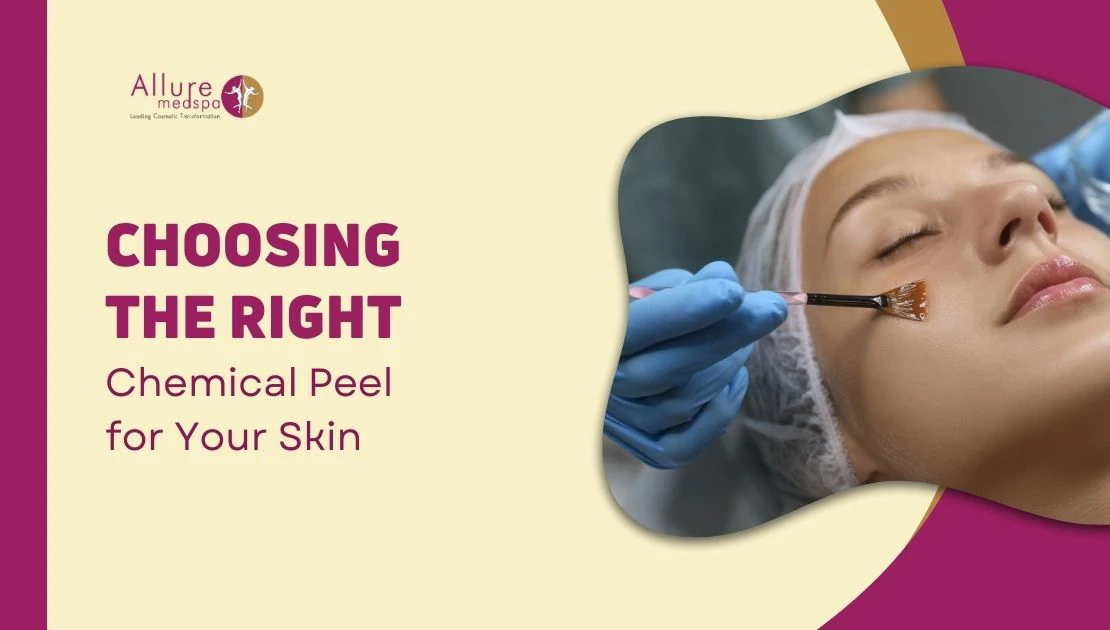 Choosing the right Chemical Peel for Your Skin