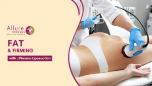 J plasma Liposuction 300x170 1